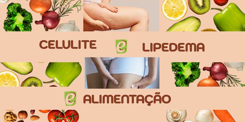 Celulite e Lipedema: Entenda as Diferenças e o Papel da Alimentação